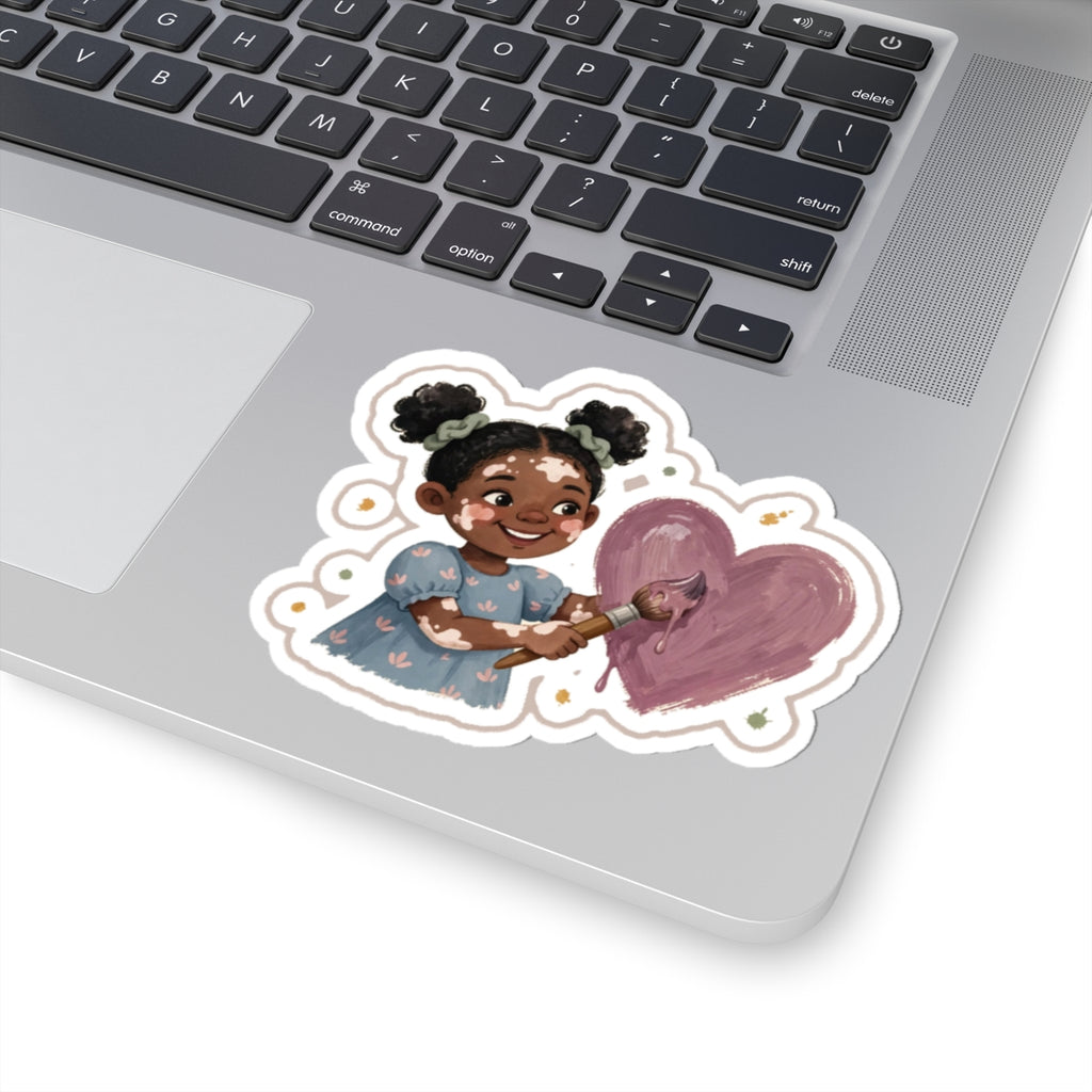 Vitiligo Paint Kiss-Cut Sticker