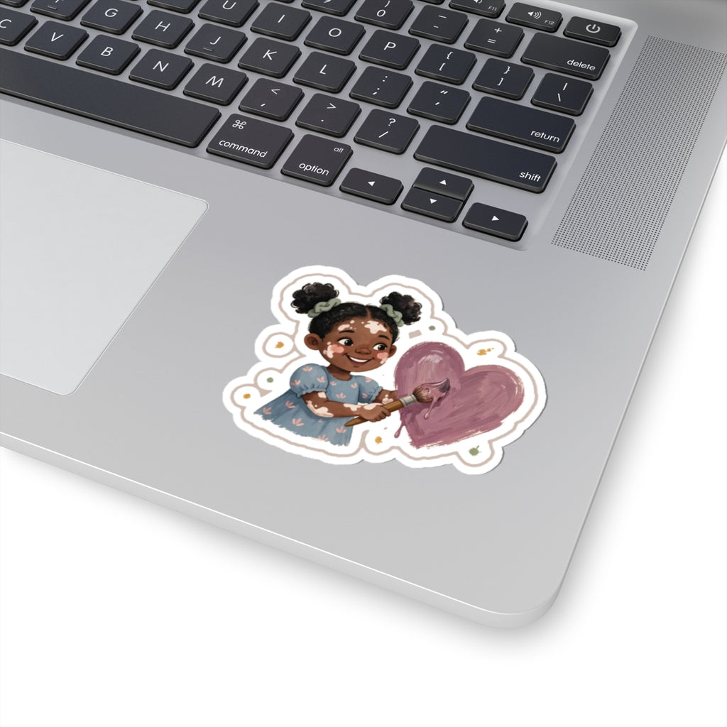 Vitiligo Paint Kiss-Cut Sticker